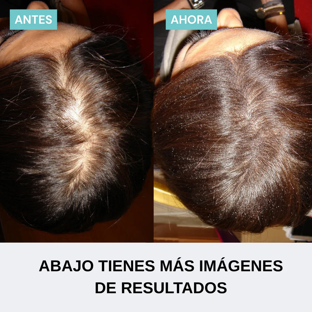 Pack confianza instantánea mujer | Densidad en 60 seg.