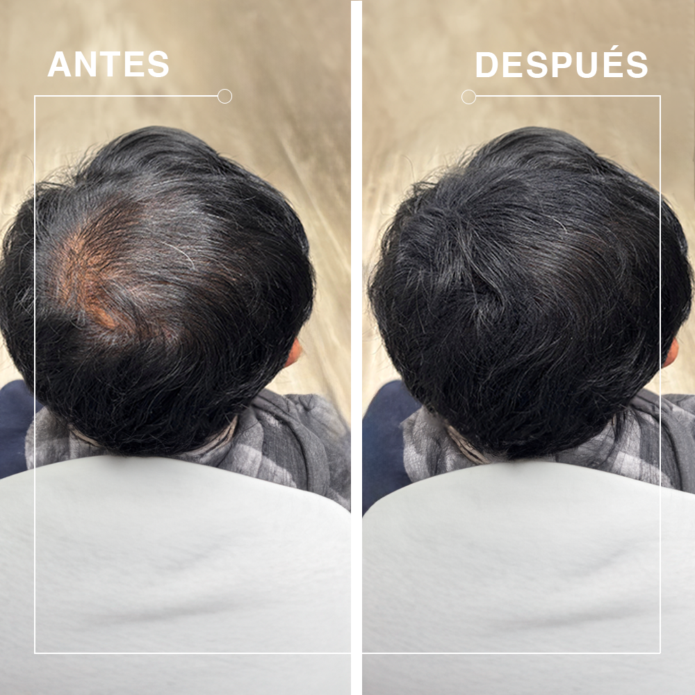 Fibras capilares de queratina