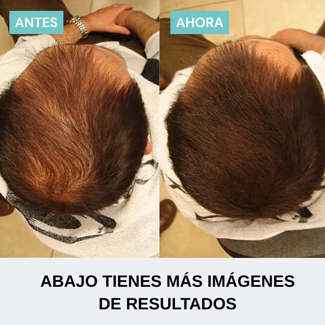 Pack confianza instantánea hombre | Densidad en 60 seg.