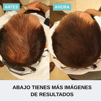 Pack confianza instantánea hombre | Densidad en 60 seg.